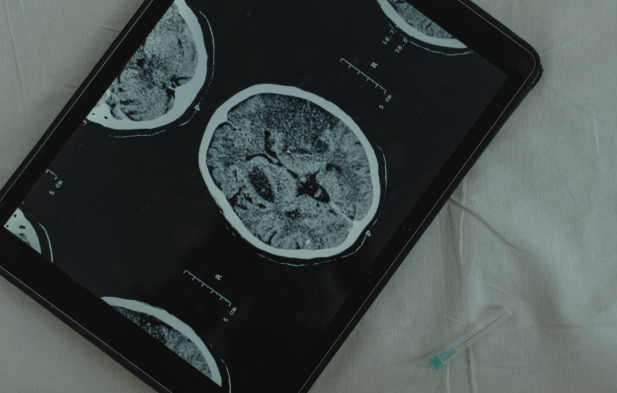 Anhedonia dhe shkaqet neurobiologjike